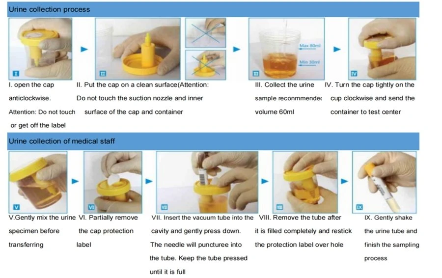 vacuum urine collection